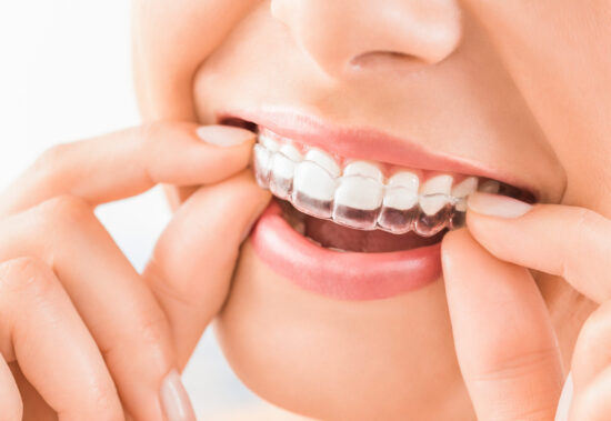 Blog - Wine Street Dental