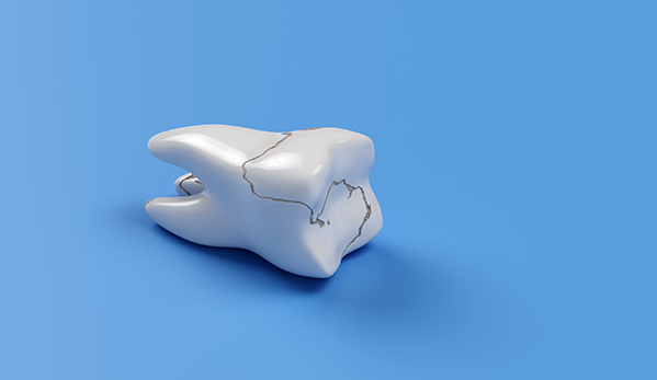 Wine Street Dental blog-inner