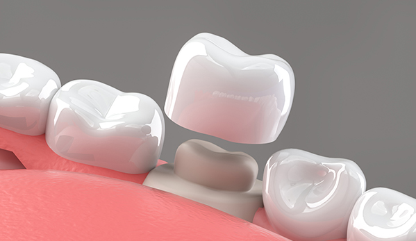 Wine Street Dental blog-inner