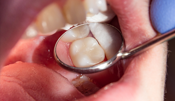 Wine Street Dental blog-inner